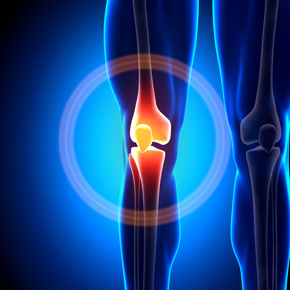 Knee